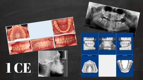 Orthodontic records and the standard of care | ID#4004 course image