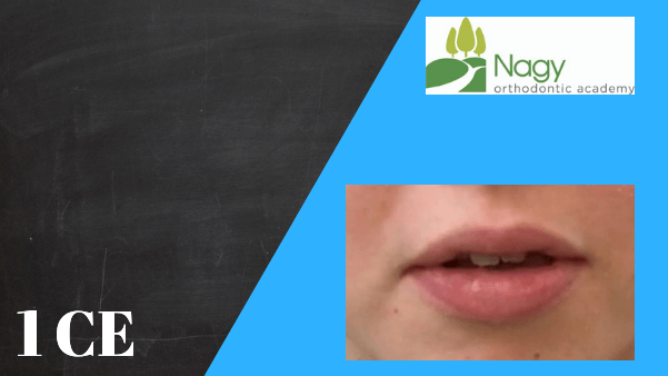 Lip Incompetence - Diagnosis and treatment